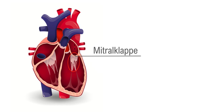 Mitralklappe - Position im Herzen