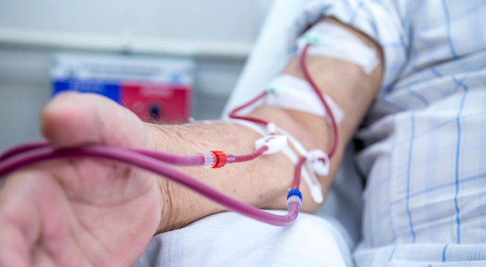 Patient bei der Hämodialyse